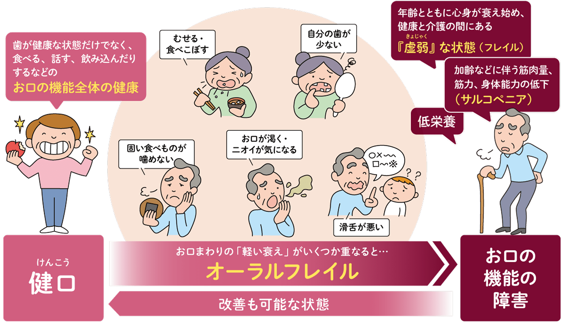 図：加齢に伴い口の機能（噛む・飲み込む・話す）が低下し、むせ・食べこぼし・滑舌低下・歯の減少などの症状が重なることで“オーラルフレイル”となり、低栄養やサルコペニアを経て口の機能障害へ進行する流れ