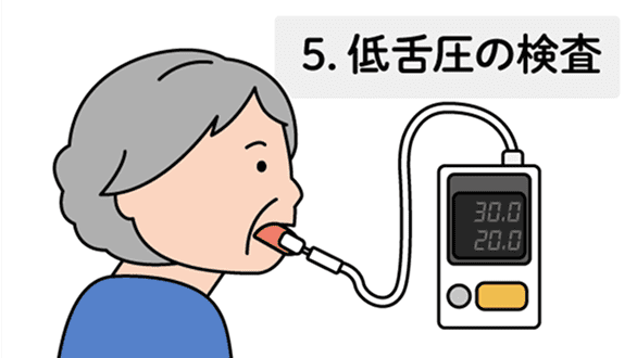 低舌圧の検査